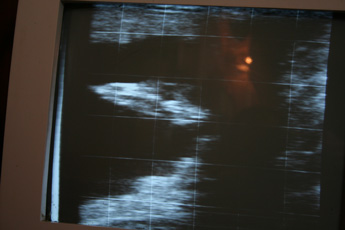 Shadowed Gold's filly scan image.